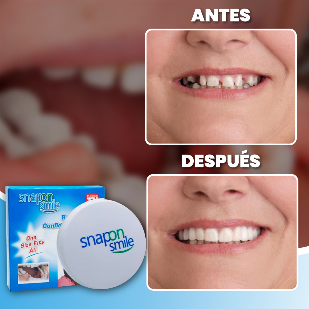 Carillas ajustables para sonrisa perfecta  + 1 GRATIS - Smile Flex™