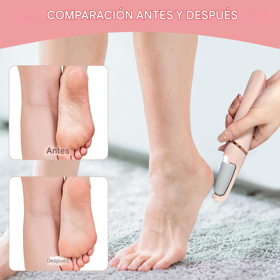 CleanFoot™ | Removedor de callos e impurezas 🌟