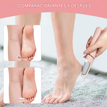 CleanFoot™ | Removedor de callos e impurezas 🌟