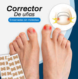 Corrector de Uñas encarnadas